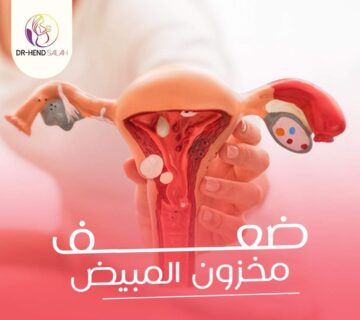 ضعف مخزون المبيض