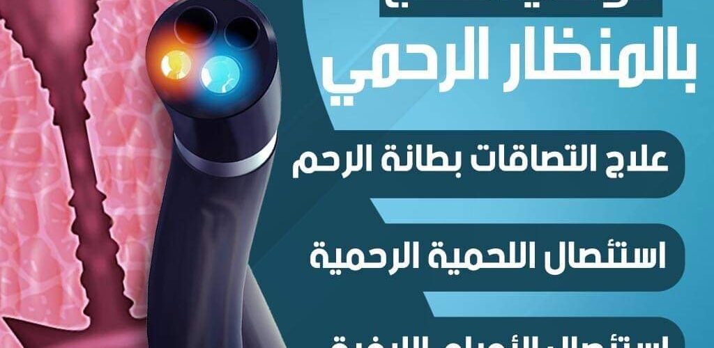 المنظار الرحمي